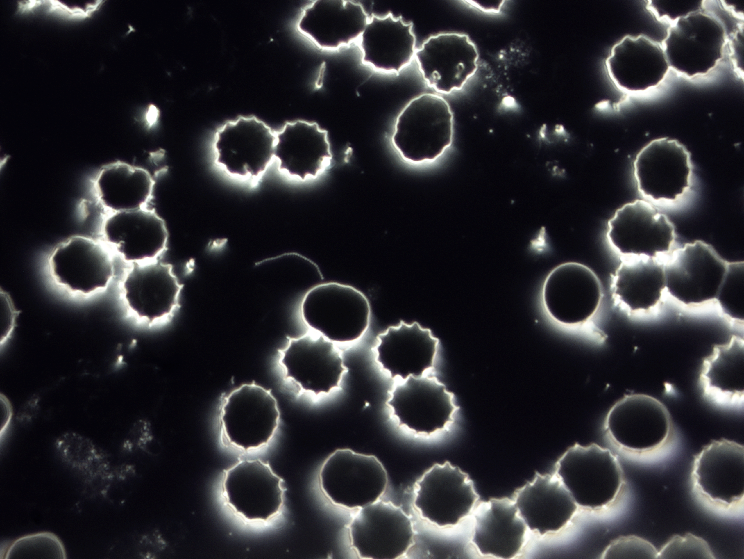 Blutzellen in der Betrachtung unter dem Dunkelfeldmikroskop